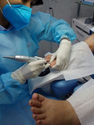 -派恩宜灰指甲鸡眼嵌甲手足癣