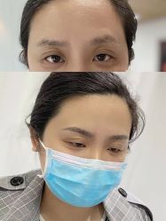 -Doris多里斯半永久纹眉·SMP纹发·发际线