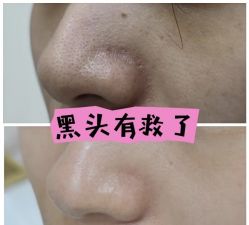 -SKIN79皮肤管理中心
