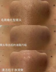 -美愈美肤MEIYU SKIN