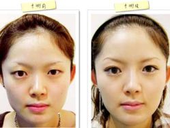 点击看大图 -SKINIST丽铂医疗美容