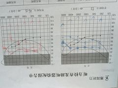 -惠耳听力助听器(赣榆东关路店)