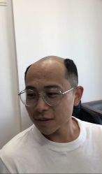 -发饰美男士增发补发假发定制店