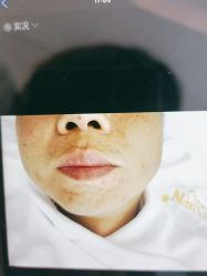 -蕾特恩专业祛痘·皮肤管理