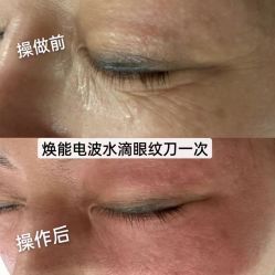 -LUNA皮相美·骨相美高级美感