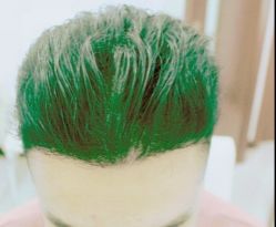 -大麦微针植发丨全国连锁