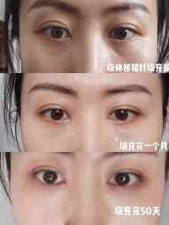 -上海漾颜医疗美容