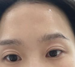 体验后-北京英煌医疗美容