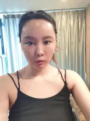 点击看大图 -禾美嘉医疗美容