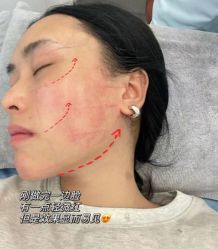 -Yestar艺星医疗美容医院