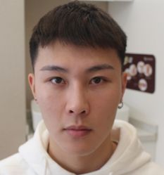 -大麦微针植发全国连锁