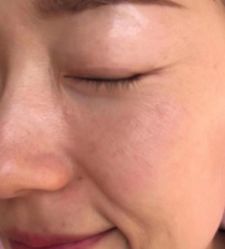 -KINI绮丽·美学肌SPA进口仪器专业店