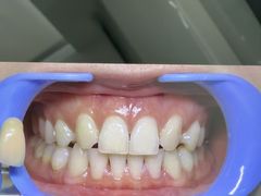 -极光口腔·矫正种植修复(锦江院区)