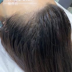 -MISS STAR·半永久纹眉·发际线·美瞳线