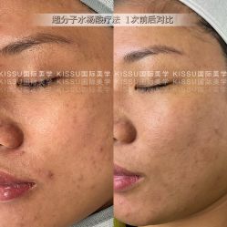 -KISS U 国际美学