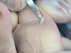 -Andrew指甲专科灰指甲·甲沟炎矫正·3D步态矫形鞋垫定制(浦三路店)