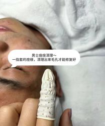 -塑青春&伊肤泉祛痘皮肤管理