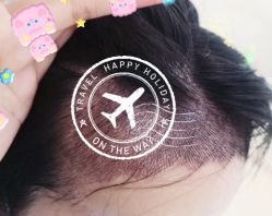 -大麦微针植发全国连锁