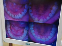 -爱牙联合口腔(门诊报销 海云庵店)