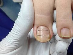 -Andrew指甲专科灰指甲·甲沟炎矫正·3D步态矫形鞋垫定制(上海法华镇路旗舰店)