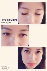 睫毛嫁接-光SPA科技美肤