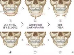 -圣嘉新医疗美容医院