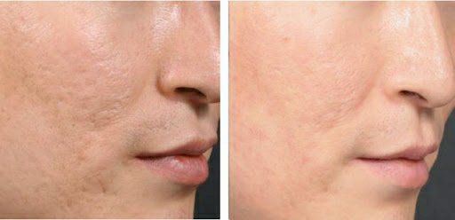 -SKINIST丽铂医疗美容