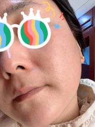 体验后-南京医科大学友谊整形外科医院