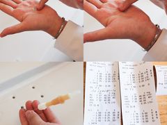 -黑马眼科·近视手术