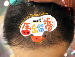 -大麦微针植发全国连锁