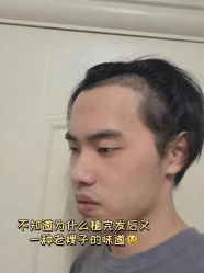 -雍禾植发全国连锁