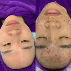 -蕾特恩专业祛痘·皮肤管理