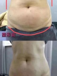 -香薇妮丝·定制减肥·身材管理