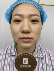 -天津健丽·去眼袋医疗美容机构