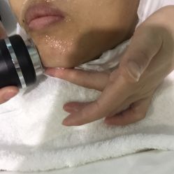 超音波仪器导入胶原蛋白-薇漫里纹眉半永久连锁品牌