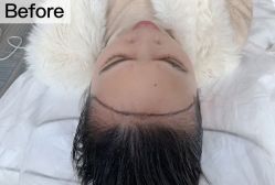 -西施无菌半永久纹绣眉眼影唇轻增发纹发际线