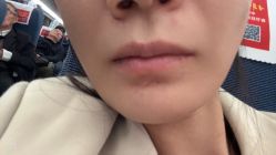 -安徽合肥韩美整形外科医院