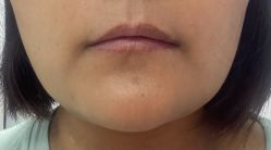 体验后-西安伊美尔医疗美容医院