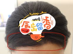 -大麦微针植发全国连锁