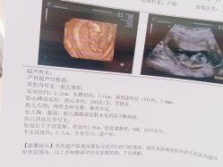 点击看大图 -潍坊艾玛妇产医院