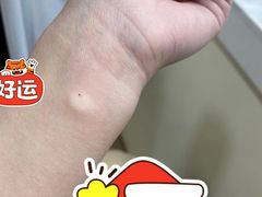 -浙江省立同德医院(翠苑院区)