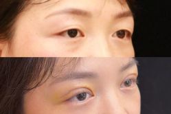 -Yestar 嘉兴艺星医疗美容医院