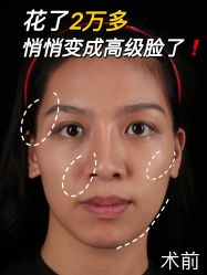 -广州美莱医疗美容医院