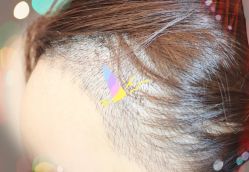 -大麦微针植发全国连锁