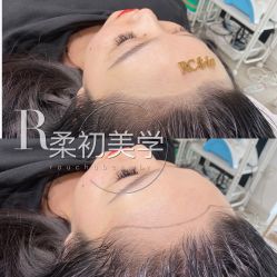 -RC半永久纹眉纹发际线