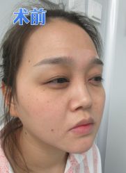 -素美医疗美容·西南眼鼻整形·修复基地