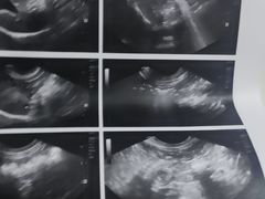 -爱妮康宠物医院·干细胞免疫细胞·肿瘤·心脏(张江店)