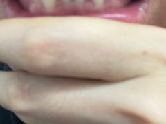 -微笑牙科口腔(三亚迎宾院区)