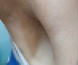 -北京美痣堂古方祛痣斑疣瘊