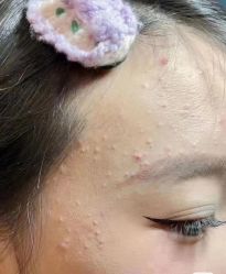 -元熙兰积皮肤管理